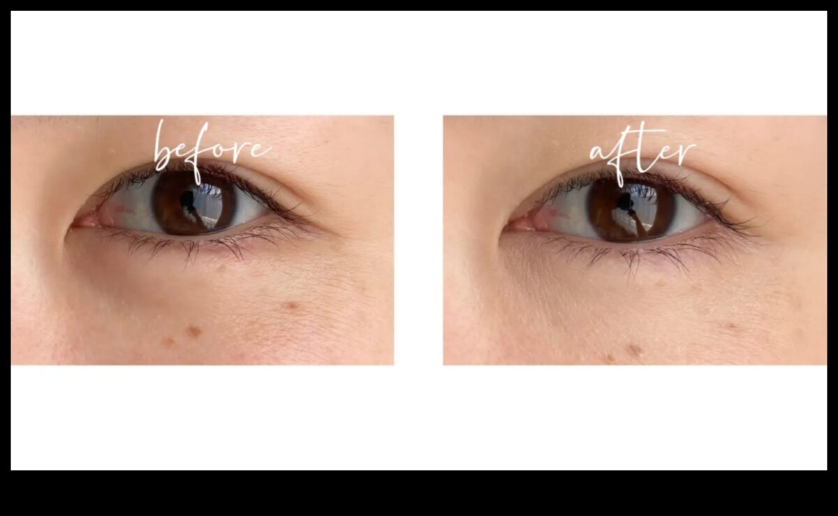 Zemacu eliksīri: tumšo loku likvidēšana ar perfektu korektoru