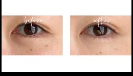 Zemacu eliksīri: tumšo loku likvidēšana ar perfektu korektoru