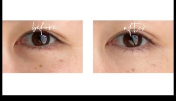 Zemacu eliksīri: tumšo loku likvidēšana ar perfektu korektoru